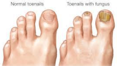 is toe fungus contagious