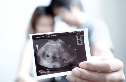 when do you get your first ultrasound