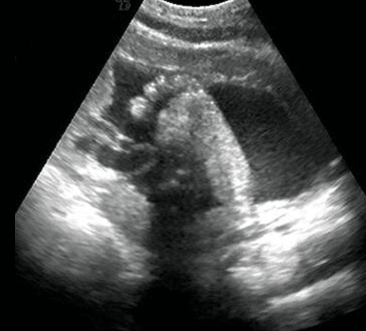 30 weeks pregnant ultrasound