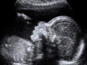 32 weeks pregnant ultrasound