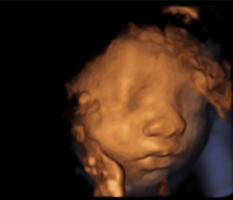 28 week 3d ultrasound