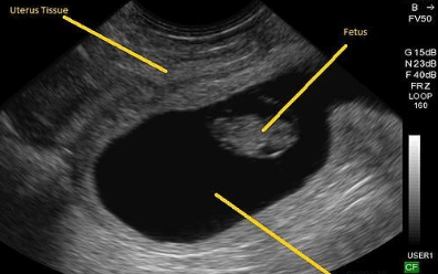 how to read an ultrasound