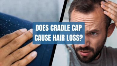 Cradle Cap